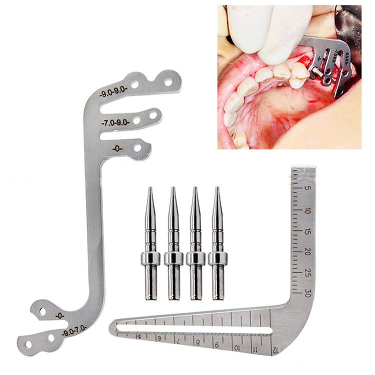 SDT-DILG Dental Implant Locating Guide